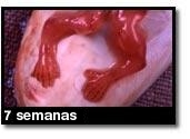 Foto de um aborto - 7 semanas
